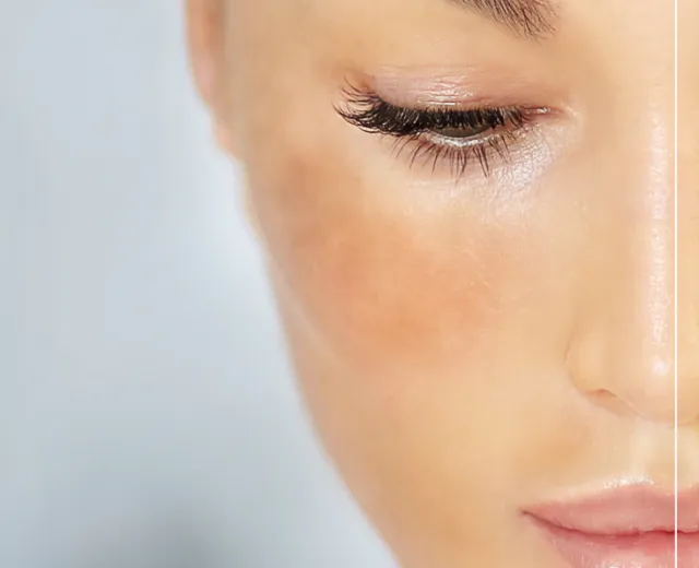 D Melasma Clear
